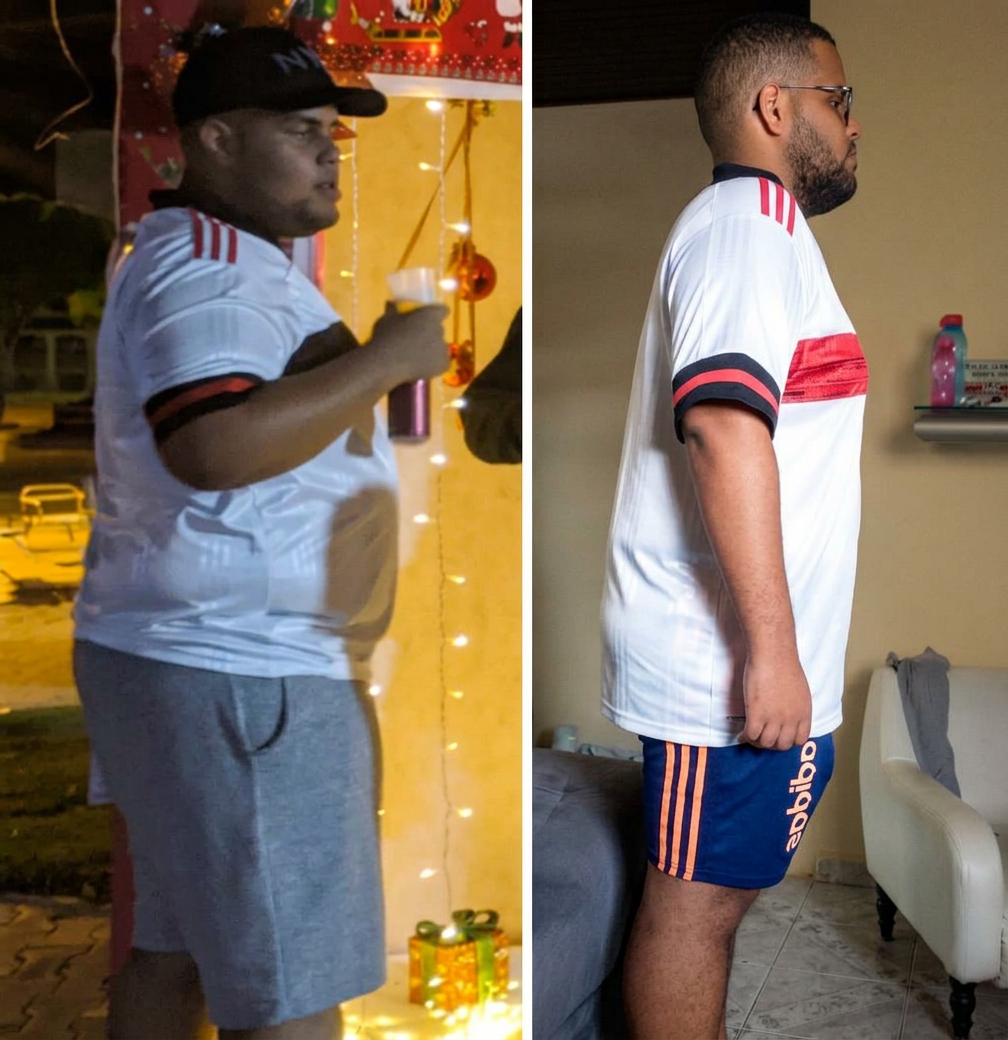 Antes & Depois