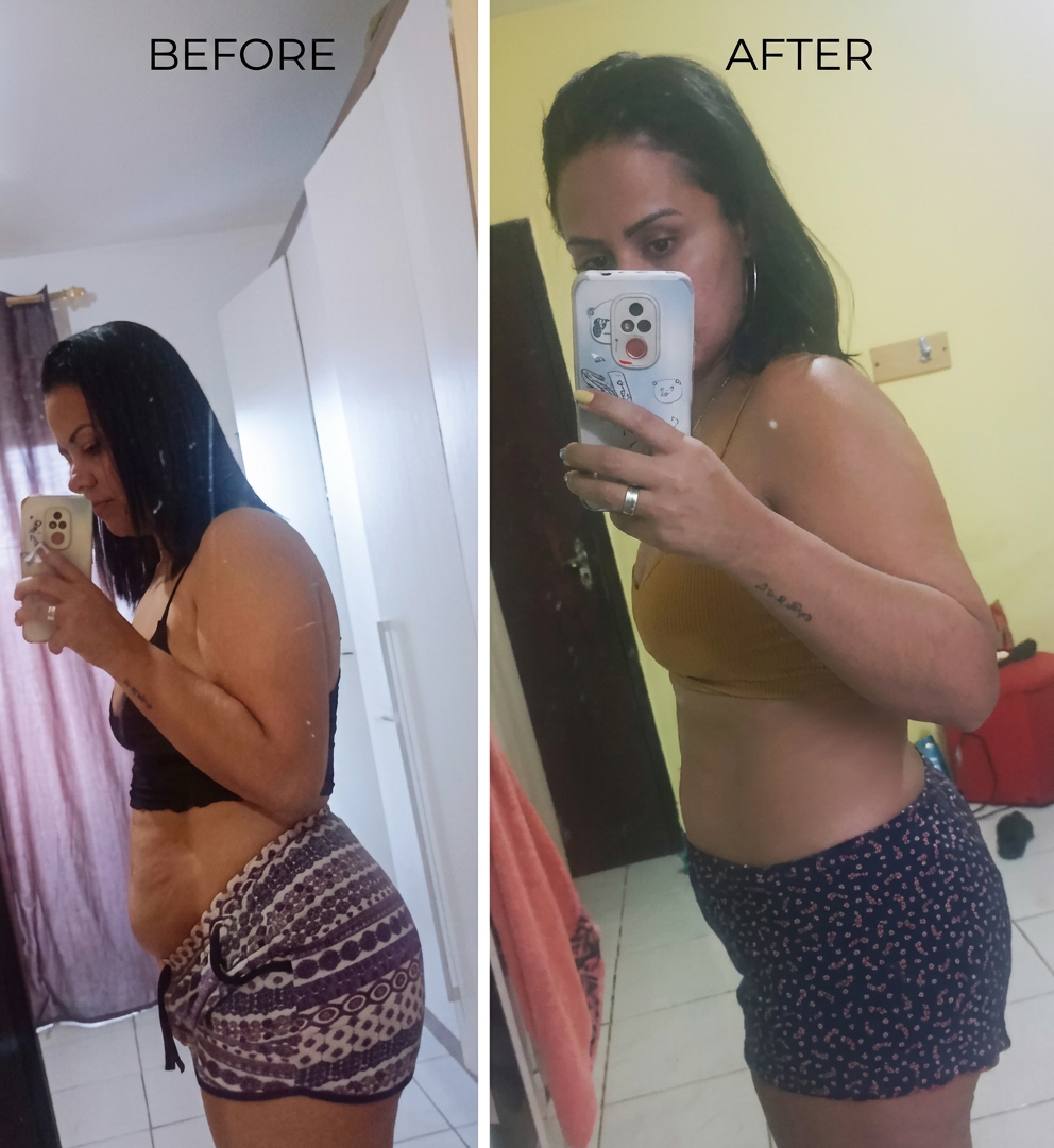 Antes & Depois